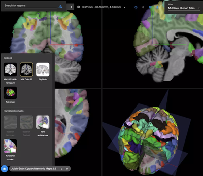 User interface of the interactive 3D viewer for accessing the multilevel brain atlas 